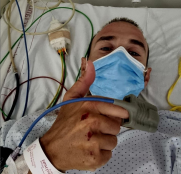 Alejandro Valverde, atropello… sin graves consecuencias mientras entrenaba