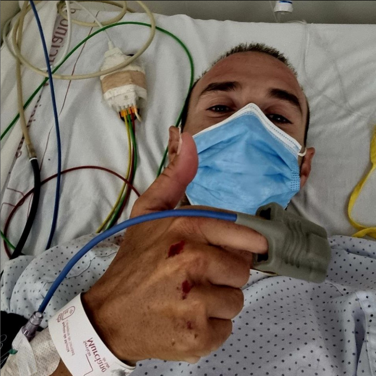 Alejandro Valverde, atropello… sin graves consecuencias mientras entrenaba